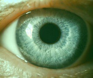 بیماری‌های چشمی | شایع‌ترین و خطرناک‌ترین بیماری‌های چشم