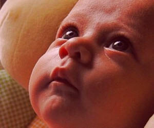 کوچکترین فرد مبتلا به دیابت نوع 2 در جهان شناسایی شد