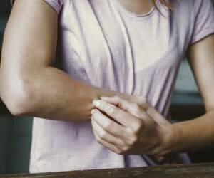 علل و نشانه‌های درماتوگرافی سفید و روش‌های درمان دارویی و خانگی