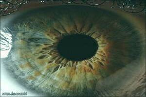 کاشت تلسکوپ در چشم: معجزه بینایی پس از 40 سال