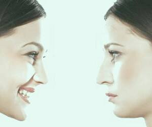 بهترین نکات پس از جراحی زیبایی بینی