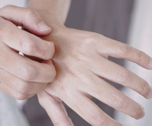 بررسی علل و راه‌های درمان عفونت قارچی پوست