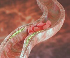 پیشگیری و مدیریت سطح کلسترول خون