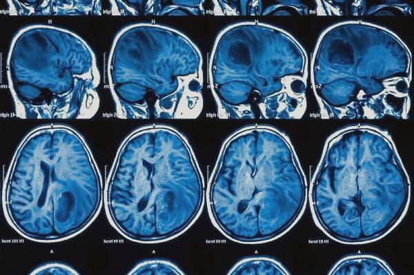 تصویربرداری نانو