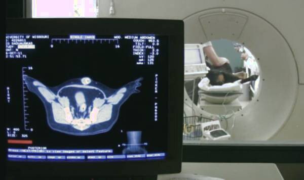 تشخیص سرطان