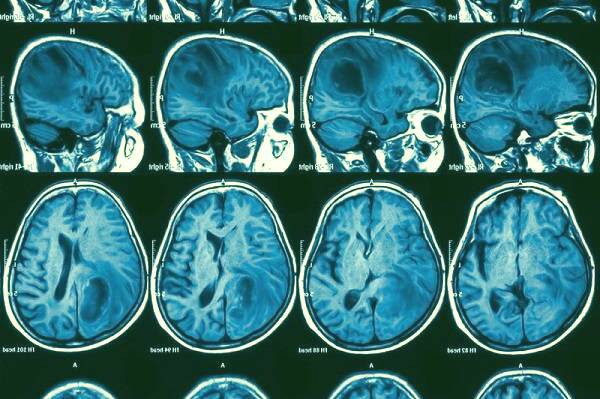 تصویربرداری نانو